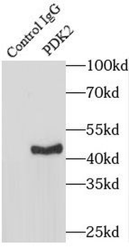 PDK2 Rabbit Polyclonal Antibody