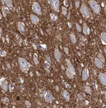 PDK2 Rabbit Polyclonal Antibody
