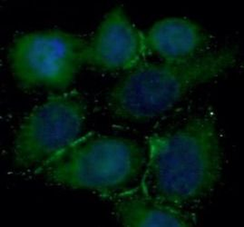 CD274 Rabbit Polyclonal Antibody