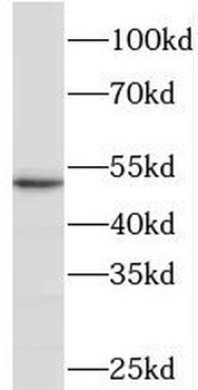 PDLIM1 Rabbit Polyclonal Antibody
