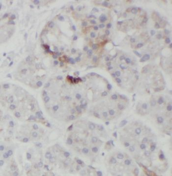 PDLIM1 Rabbit Polyclonal Antibody