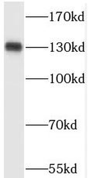 PDS5A Rabbit Polyclonal Antibody