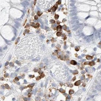 PDS5A Rabbit Polyclonal Antibody