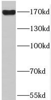 PDS5B Rabbit Polyclonal Antibody