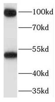 PEG10 Rabbit Polyclonal Antibody