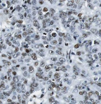 PEG10 Rabbit Polyclonal Antibody
