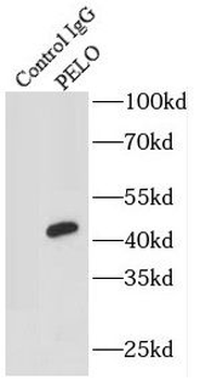 PELO Rabbit Polyclonal Antibody