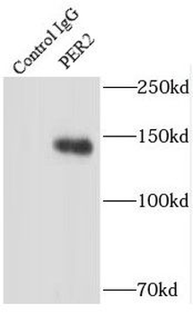 PER2 Rabbit Polyclonal Antibody