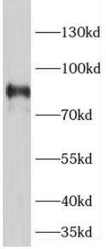 POSTN Rabbit Polyclonal Antibody