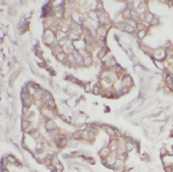 POSTN Rabbit Polyclonal Antibody