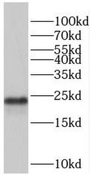 PRDX2 Rabbit Polyclonal Antibody
