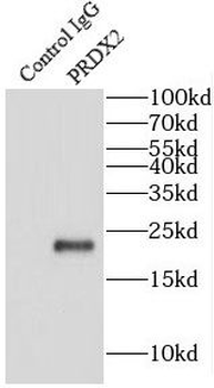 PRDX2 Rabbit Polyclonal Antibody