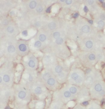 PRDX2 Rabbit Polyclonal Antibody