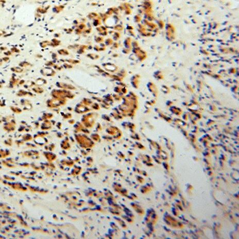 PEX19 Rabbit Polyclonal Antibody