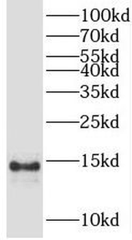 PFDN1 Rabbit Polyclonal Antibody
