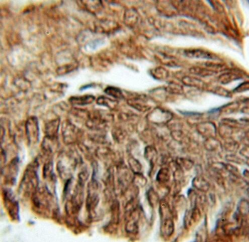 PFDN1 Rabbit Polyclonal Antibody