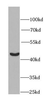PGK1 Rabbit Polyclonal Antibody