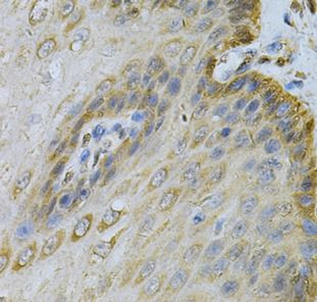 PGK1 Rabbit Polyclonal Antibody