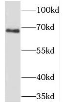 PHACTR1 Rabbit Polyclonal Antibody