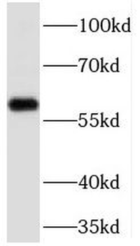 JADE1 Rabbit Polyclonal Antibody
