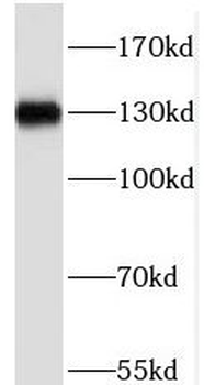 PHF20 Rabbit Polyclonal Antibody