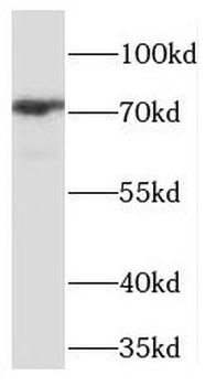 PHF21A Rabbit Polyclonal Antibody