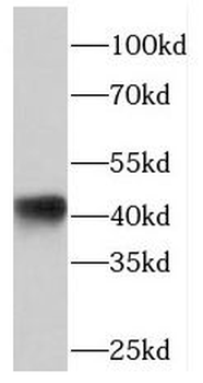 PHLDA1 Rabbit Polyclonal Antibody