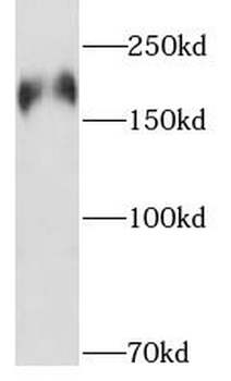 PHLPP1 Rabbit Polyclonal Antibody