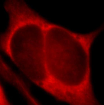 PHLPP1 Rabbit Polyclonal Antibody