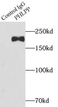 PHLPP1 Rabbit Polyclonal Antibody
