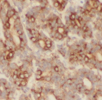 PHLPP1 Rabbit Polyclonal Antibody