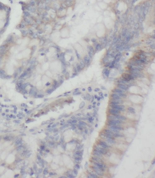 PHLPP2 Rabbit Polyclonal Antibody