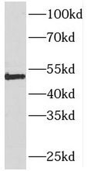 PIGM Rabbit Polyclonal Antibody