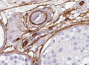 PIGM Rabbit Polyclonal Antibody