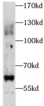 PIGZ Rabbit Polyclonal Antibody