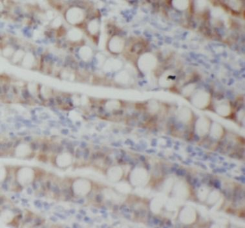 PIGZ Rabbit Polyclonal Antibody