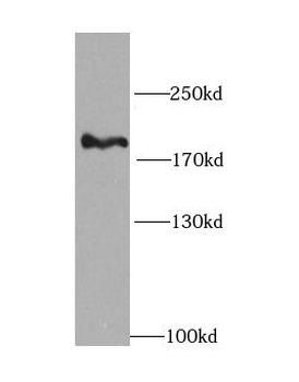 PIK3C2A Rabbit Polyclonal Antibody