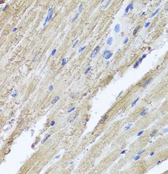 PIK3C2A Rabbit Polyclonal Antibody