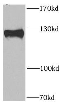 PITRM1 Rabbit Polyclonal Antibody