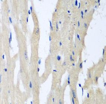 PITRM1 Rabbit Polyclonal Antibody