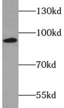 PRKCE Rabbit Polyclonal Antibody