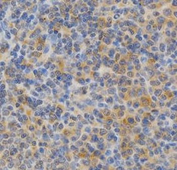 PRKCE Rabbit Polyclonal Antibody