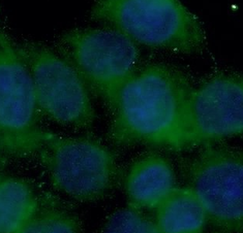 PRKCI Rabbit Polyclonal Antibody