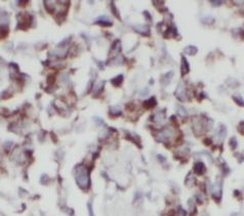 PRKCI Rabbit Polyclonal Antibody