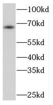 PRKCZ Rabbit Polyclonal Antibody