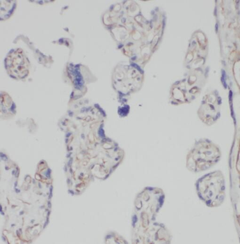 PRKCZ Rabbit Polyclonal Antibody
