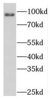 PKD2L1 Rabbit Polyclonal Antibody