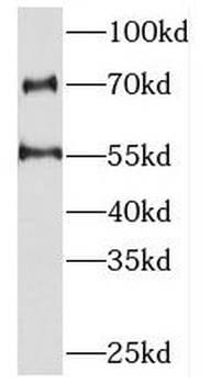 PKNOX2 Rabbit Polyclonal Antibody