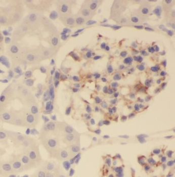 PKNOX2 Rabbit Polyclonal Antibody