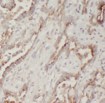PLA2G12A Rabbit Polyclonal Antibody